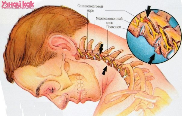 Если у вас болит шея.