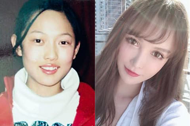 30-летняя китаянка перенесла более ста пластических операций в погоне за идеальной внешностью