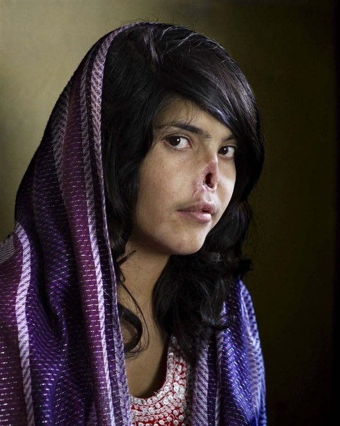 6. Взгляд, полный мужества: 18-летняя Биби Айша из Афганистана сбежала от мужа, бойца Талибана, из-за постоянного насилия. За побег ей отрезали нос и уши. в мире, интересное, исторические кадры, подборка, редкие фото, снимки, события, фото