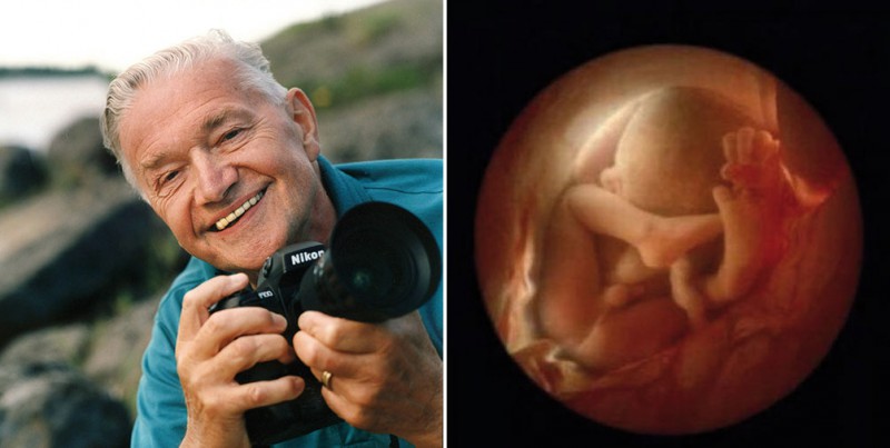 Уникальные кадры — от зачатия до рождения - похожая новость на Toplenta