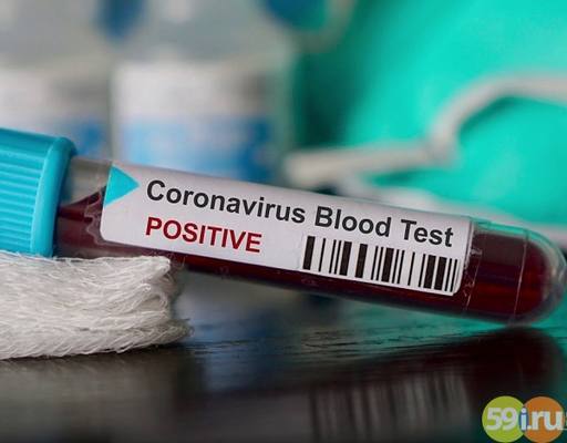 Коэффициент распространения коронавируса в Пермском крае уменьшился до 0,99