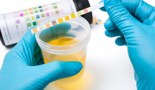 Уринотерапия