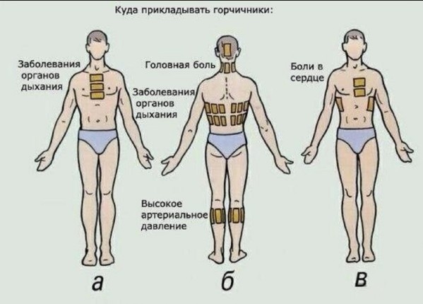 8 рецептов применения горчичников при кашле и простуде. Дешево, эффективно, минимум вреда