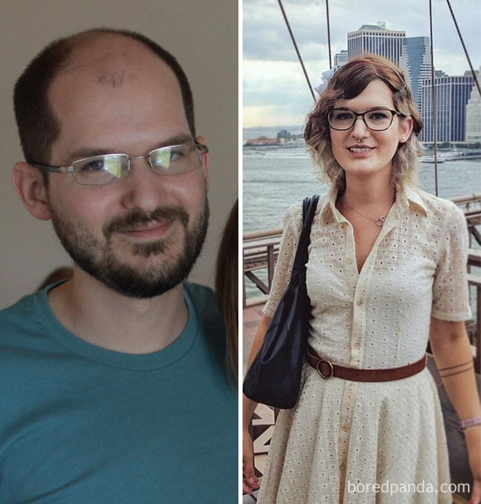 30-Year-Old Male To Female, 9 Months On HRT