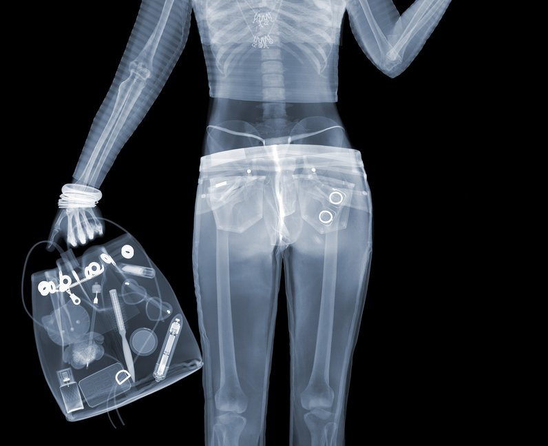 Рентген одежды для