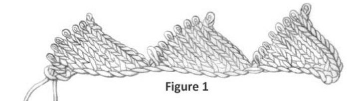 Техника плетеного вязания энтерлак шаг за шагом... Увлекательная технология вязания!