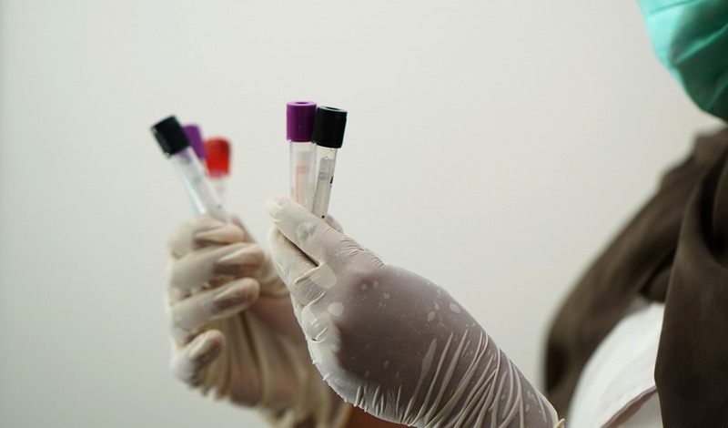 Более 100 человек за сутки заболели коронавирусом в Карелии