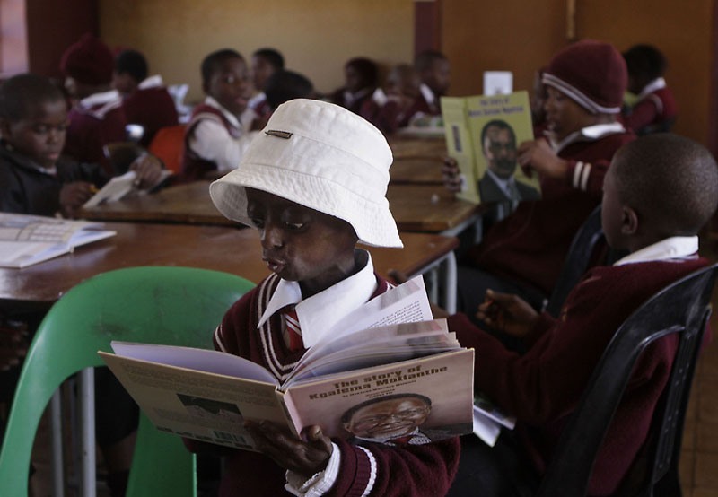 South Africa Progeria Girl