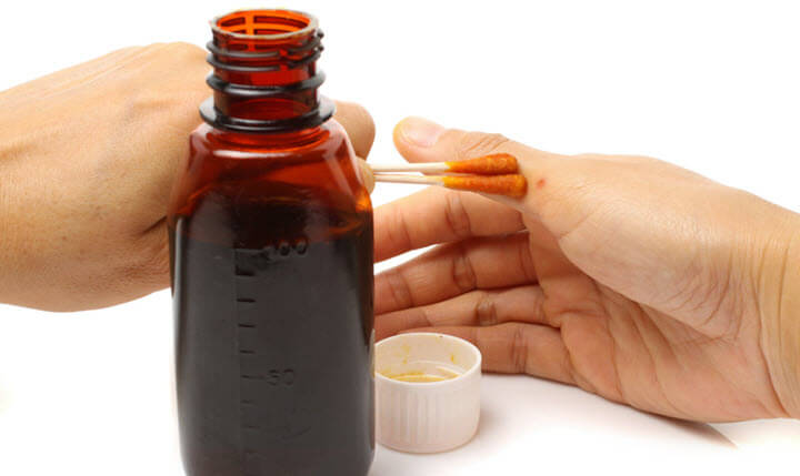 Запомни в каких случаях применять зеленку, а когда йод Запомни в каких случаях применять зеленку, а когда йод