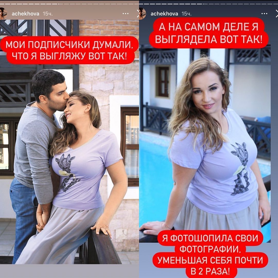 Анфиса Чехова призналась, что пользовалась фотошопом