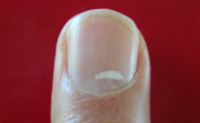 Nail-e1429132406202