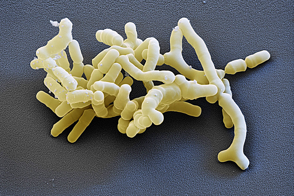 C0357893-Bifidobacterium_ba.jpg