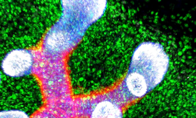 Биологи раскрыли механизм долголетия: роботы научили здоровые клетки делиться энергией Биологи раскрыли механизм долголетия: роботы научили здоровые клетки делиться энергией которые, клетки, митохондриями, стволовые, клеток, кислорода, клетках, может, сердца, сердечнососудистых, поврежденными, микроскопические, делиться, Выяснилось, гладкой, мускулатуры, Ученые, присутствуют, сердце, обычно