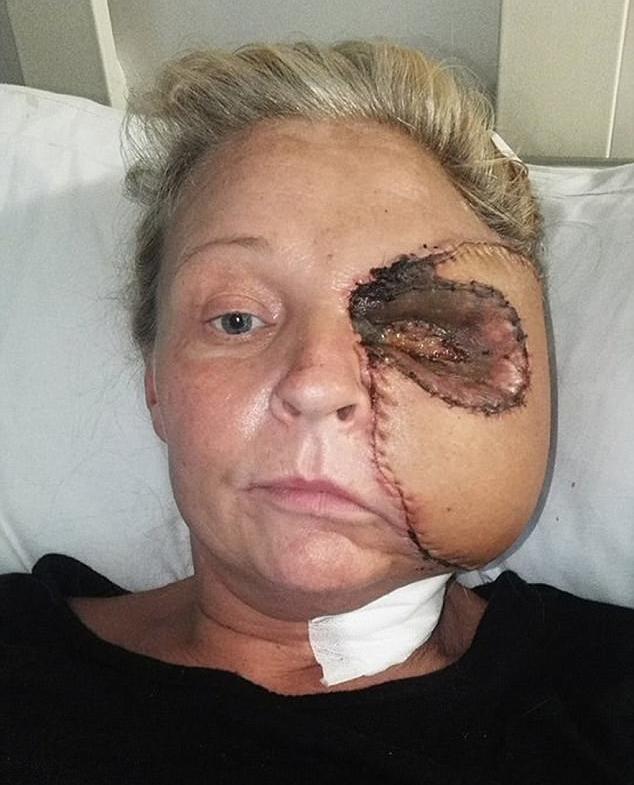 Женщина потеряла половину лица после удара о духовку