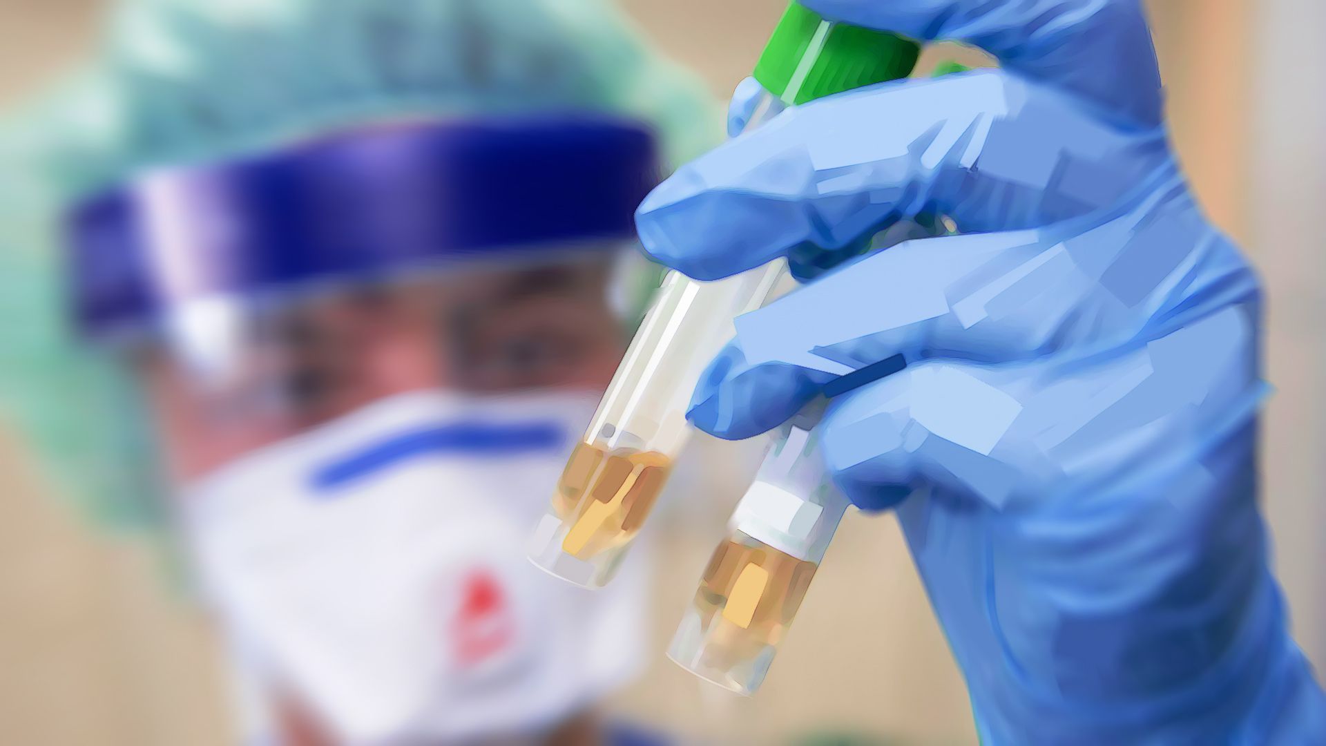 MedRxiv: коронавирус меняет активность генов в клетках иммунитета