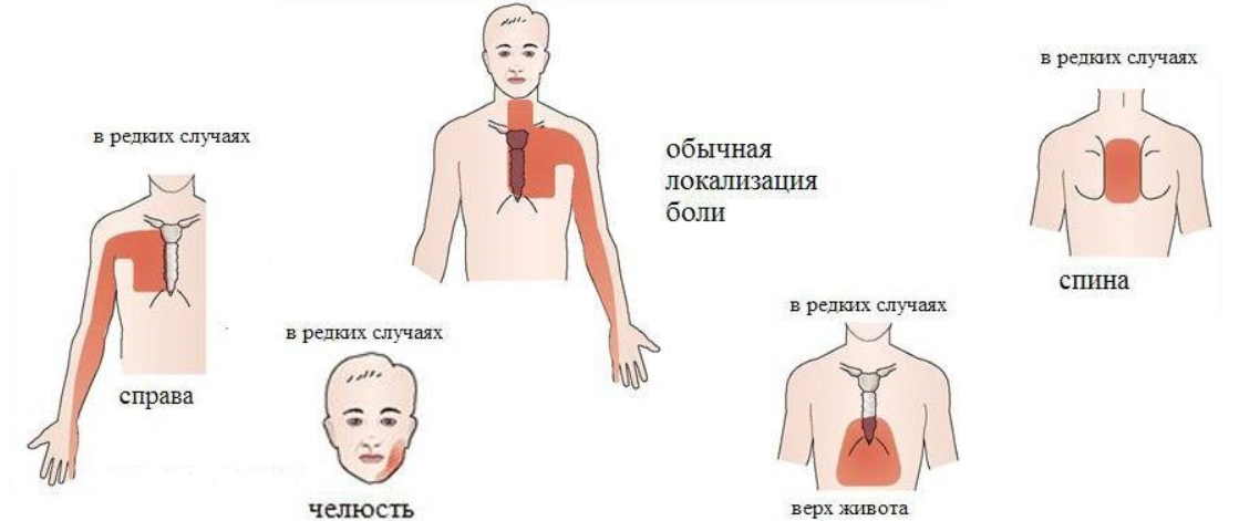 Когда болит сердце. Боль в сердце симптомы. Болт в сердце симптомы. Локализация боли при ИБС.