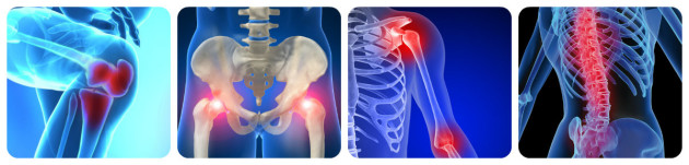 Боль в суставах