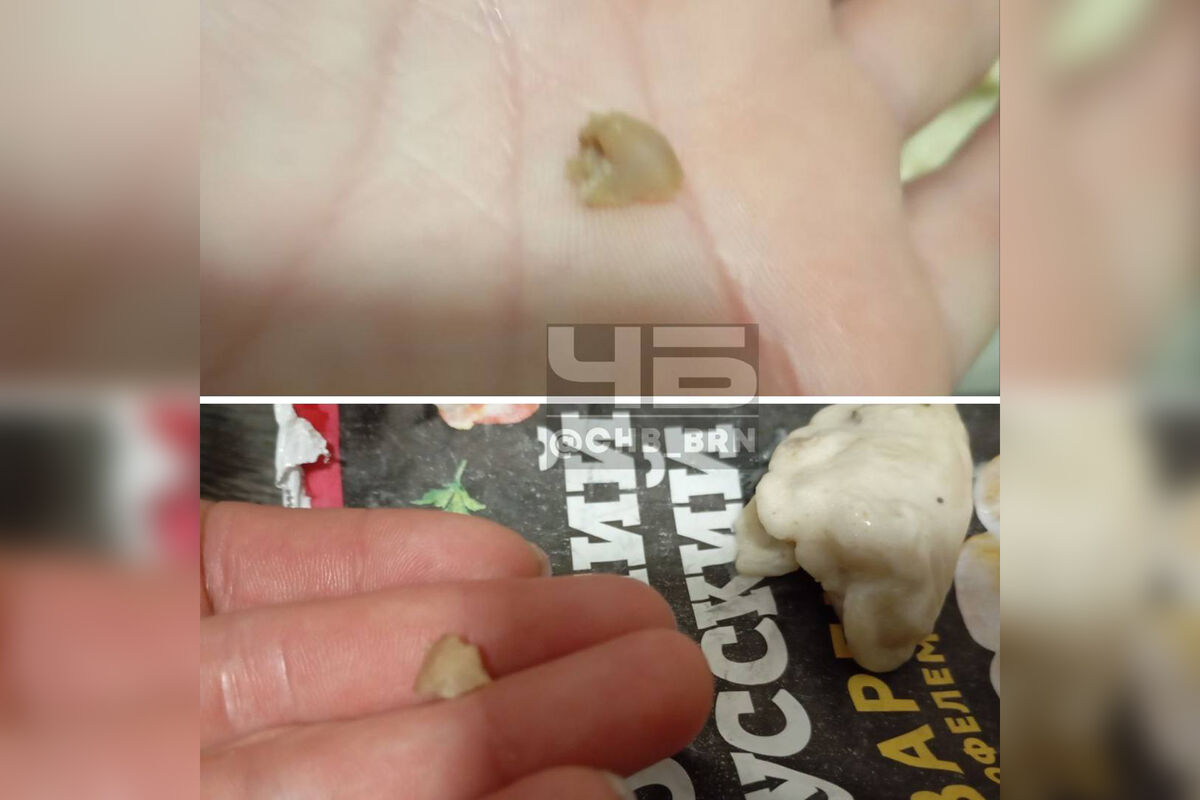 Жительница Барнаула показала зуб, который нашла в варениках