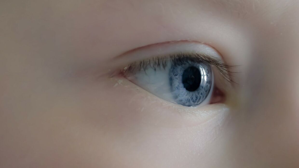 Врожденная катаракта проявляется в раннем возрасте и очень опасна