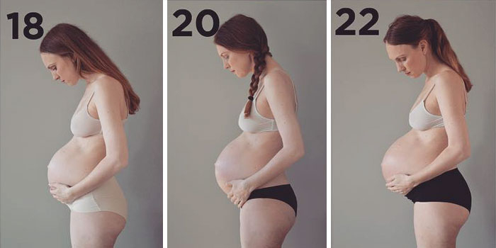 Как выглядит живот женщины беременной тройней, 36-летняя Мария беременна тройней 