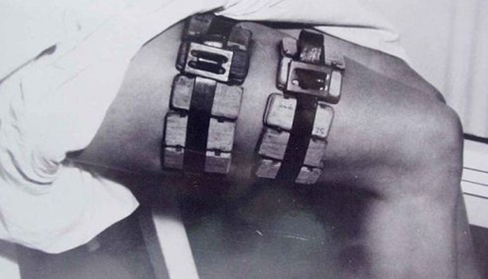 7 диких врачебных инструментов из прошлого 7 диких врачебных инструментов из прошлого врачи