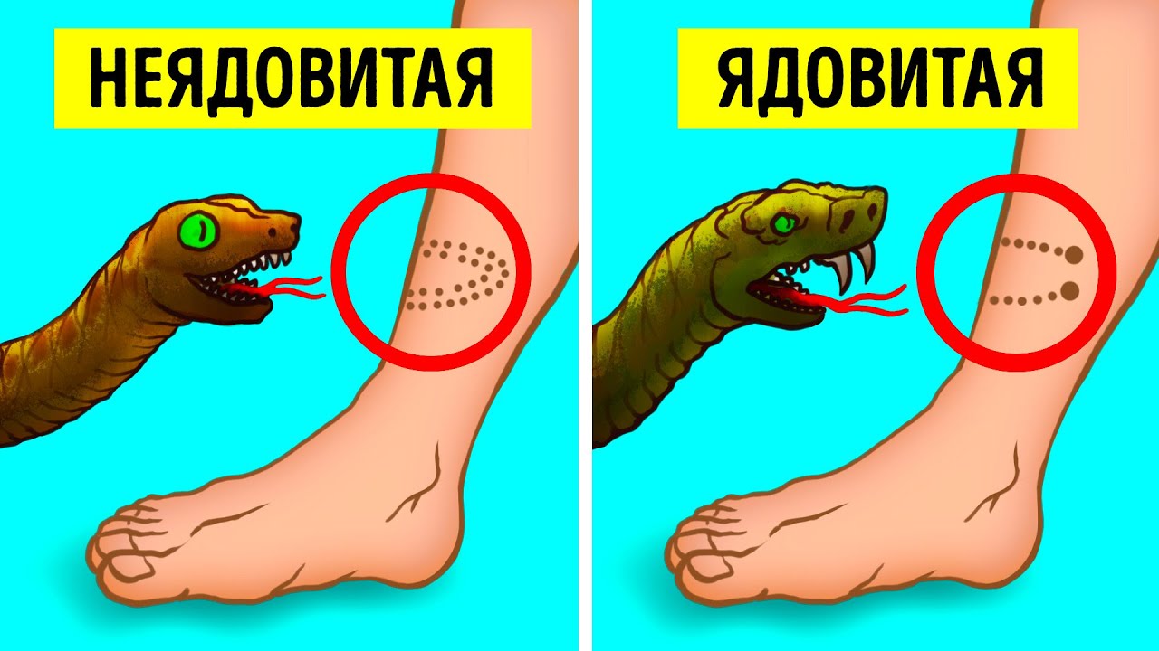 как отличить укус ядовитой и неядовитой змеи