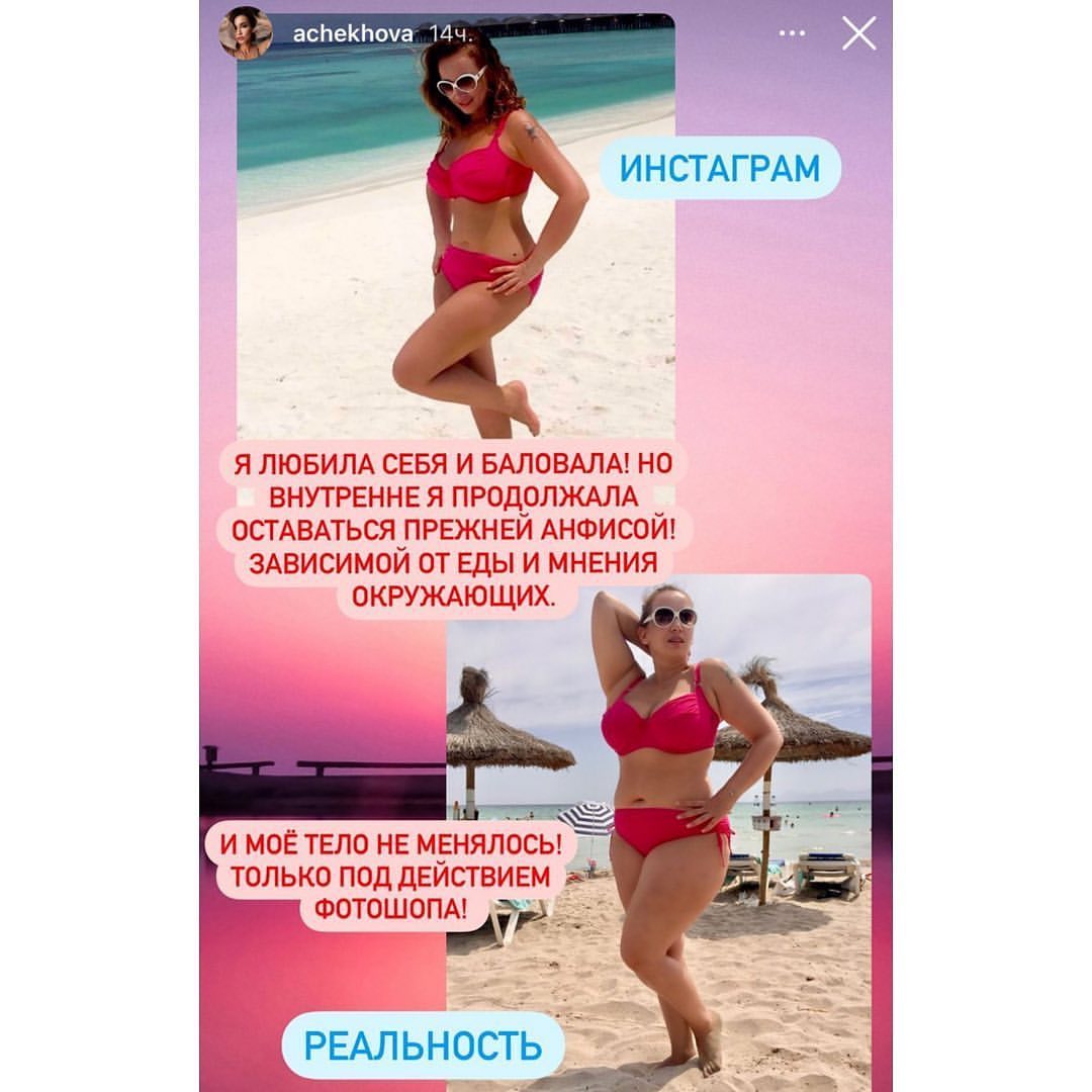 Анфиса Чехова призналась, что пользовалась фотошопом