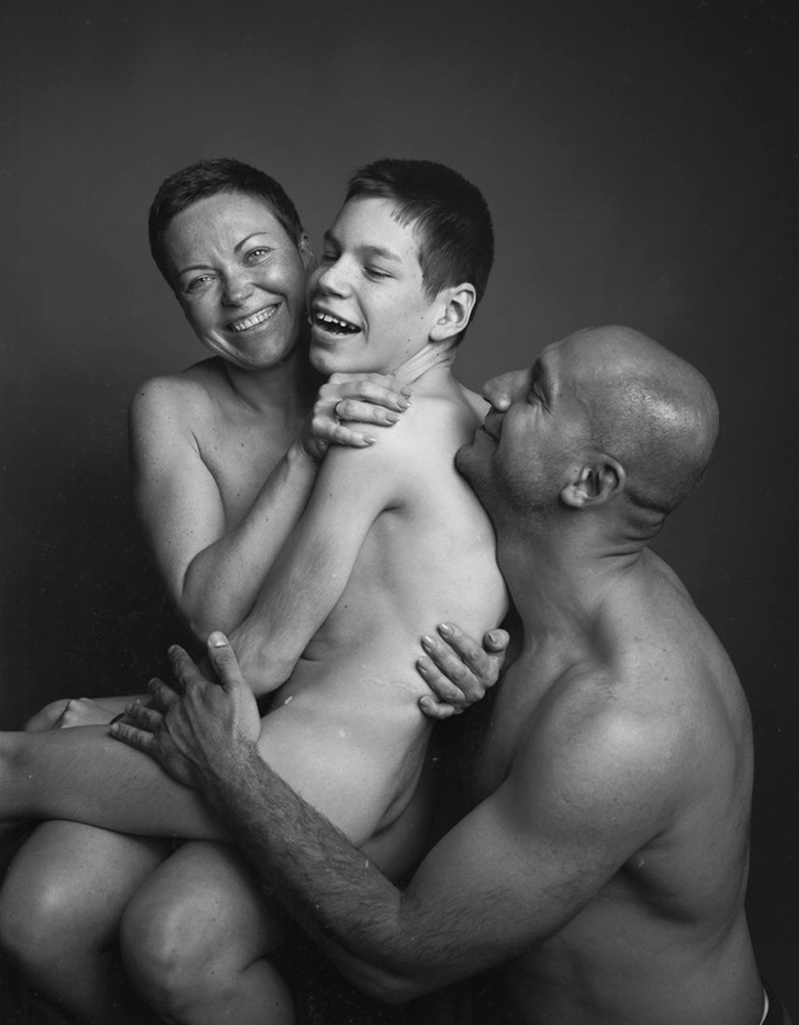 Фотопроект «Будь любым» показывает обжигающую правду о людях, которые сильно отличаются от других воспитание,Дети,Жизнь,Истории,Отношения,проблемы