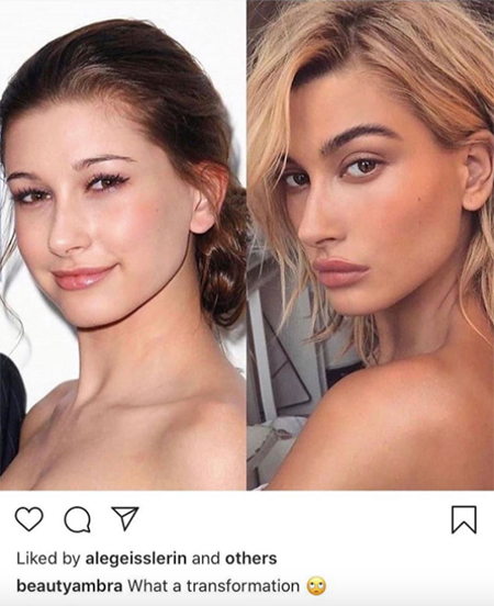 Хейли Болдуин прокомментировала новости о своих пластических операциях Хейли Болдуин прокомментировала новости о своих пластических операциях Красота,Уход за кожей и волосами