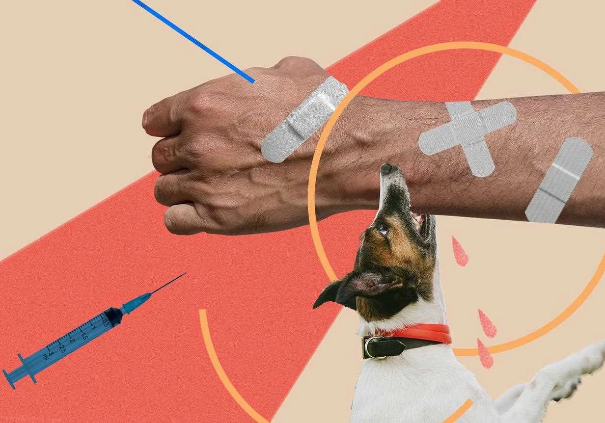 Что делать, если вас укусила собака: советы по первой помощи здоровье и медицина,первая помощь,укусы животных