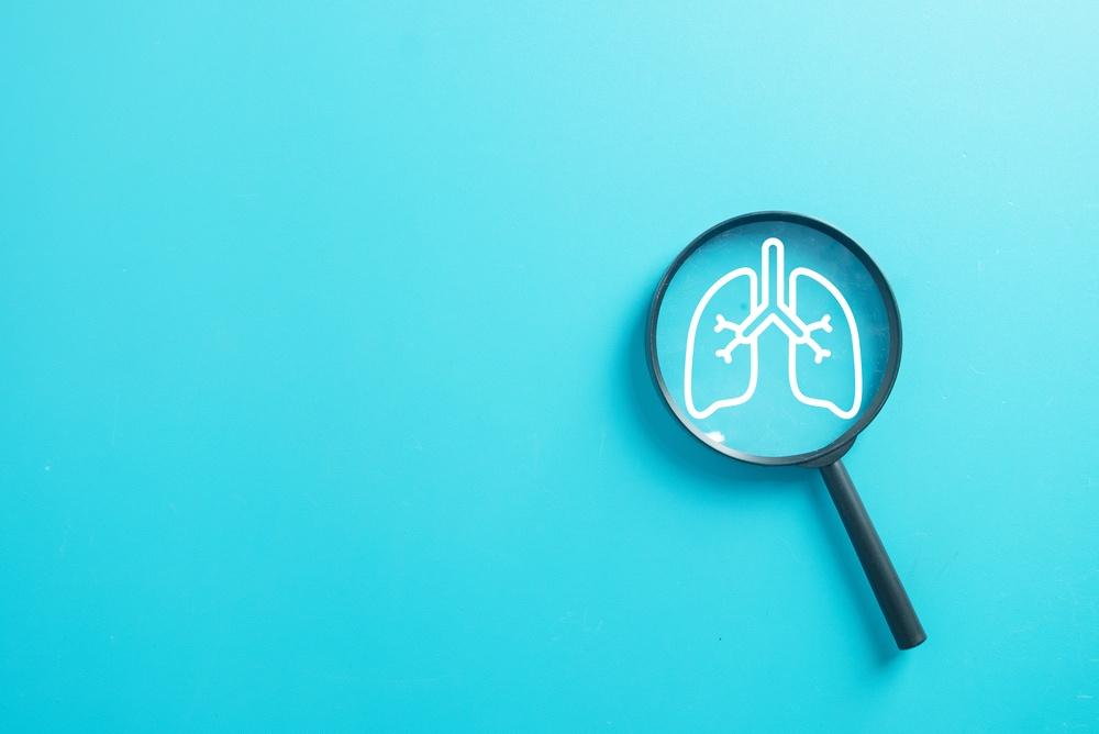 Симптом «барабанных палочек»: признак рака легких, который можно найти на пальцах ногти, между, легких, заболевания, около, наличие, пальцев, случаев, становится, может, более, который, ногтями, начинают, блестящей, гладкой, затем, больше, выгибаться, вокруг