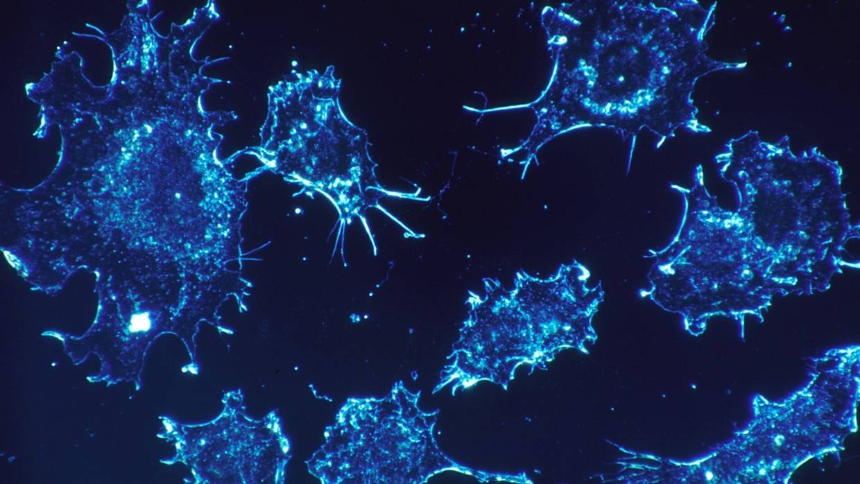 Ученые Университета Нинбо предложили использовать паразитов для лечения раковых опухолей