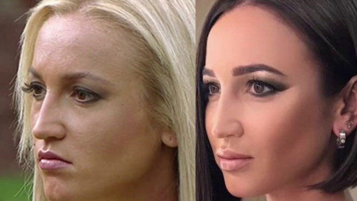 «Эволюция Бузовой»: новые фото артистки породили слухи о ее пластике «Эволюция Бузовой»: новые фото артистки породили слухи о ее пластике ольга бузова