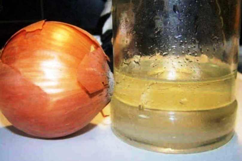 Склерозы: 5 ценных рецепта лечения!