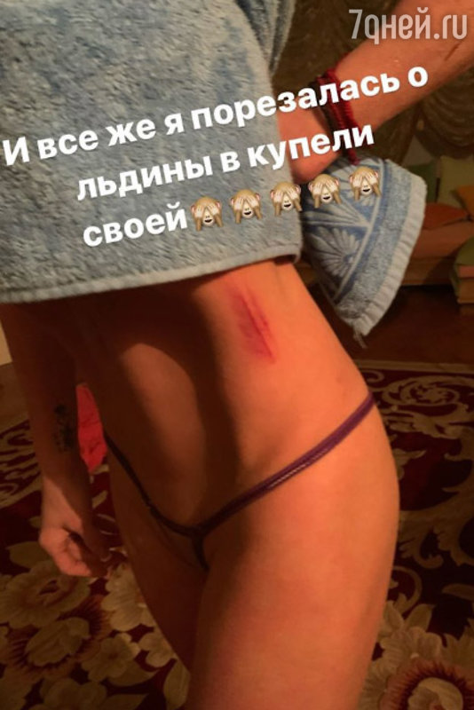 Анастасия Волочкова получила травму во время купания