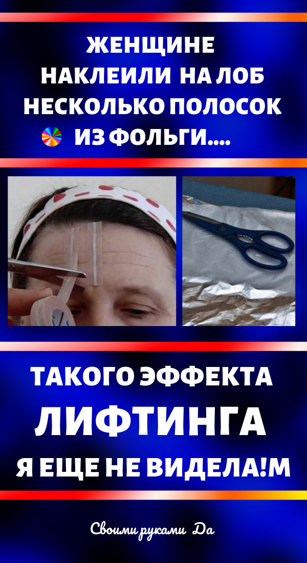 Женщине наклеили на лоб несколько полосок из фольги…. Такого эффекта лифтинга я еще не видела!