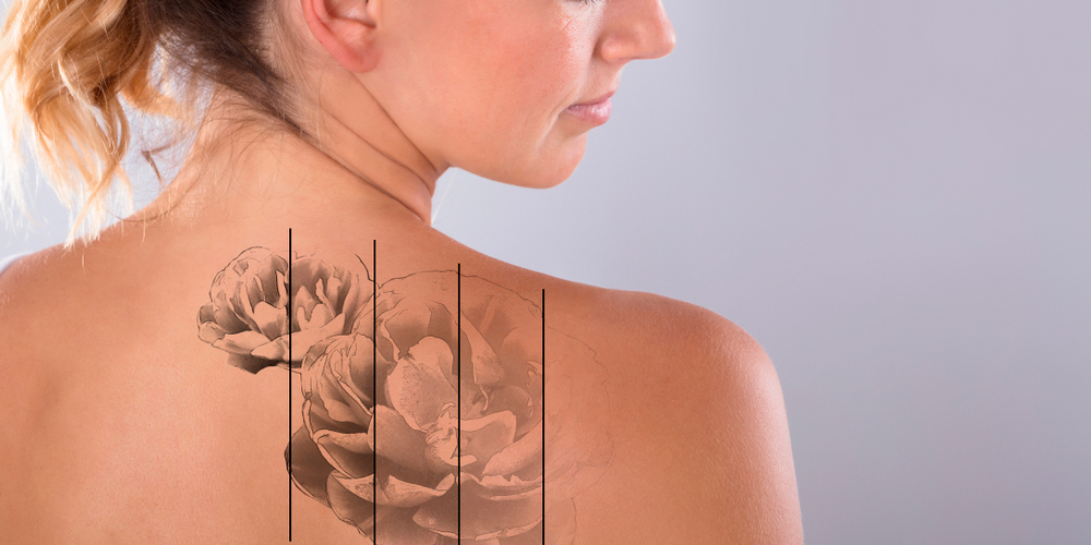 Опасная красота: о чём нужно знать, прежде чем делать татуировку татуировки, будет, лучше, сутки, может, Поэтому, мастера, чтобы, вашей, рисунок, татуировка, чернил, мастер, болезни, заболевания, иногда, кожные, вызвать, спинной, никакой