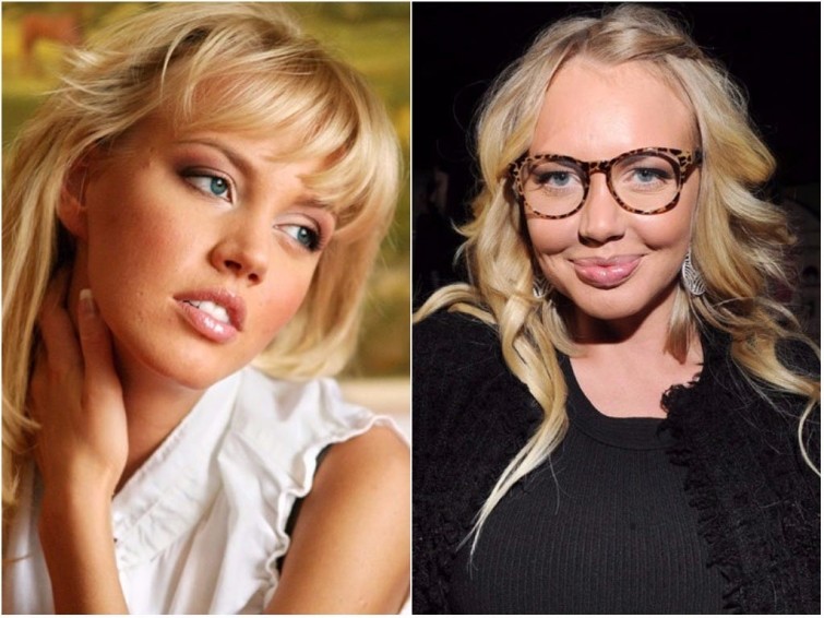 Маша Малиновская звезды, знаменитости, лицо, пластическая операция, российские звезды, тогда и сейчас, хирург