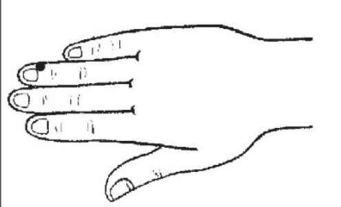 Лечение близорукости: народные рецепты и лекарства официальной медицины. Рука об руку с врачами