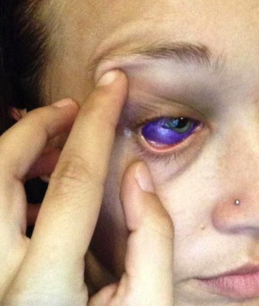Модель заплакала фиолетовыми слезами после неудачного тату на глазном яблоке