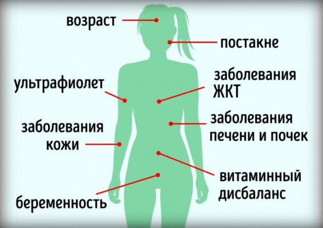 пигментные пятна1 (640x452, 112Kb)