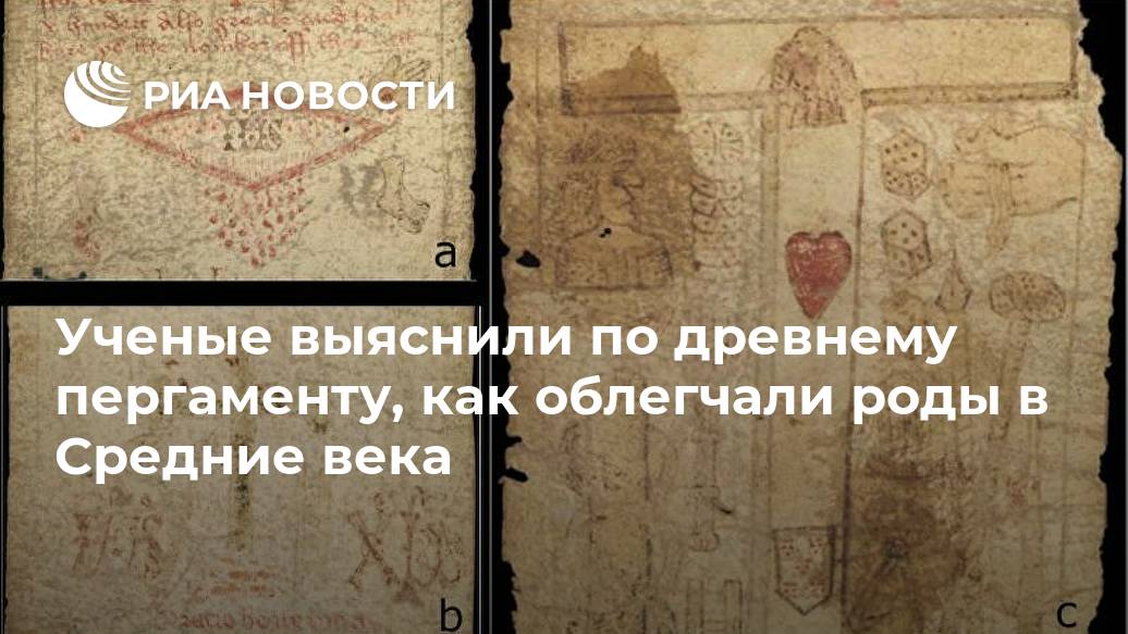 Ученые выяснили по древнему пергаменту, как облегчали роды в Средние века Ученые выяснили по древнему пергаменту, как облегчали роды в Средние века Лента новостей
