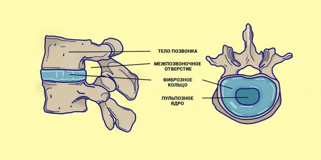 Откуда берётся грыжа позвоночника и что с ней делать болезни,грыжа,здоровье,позвоночник