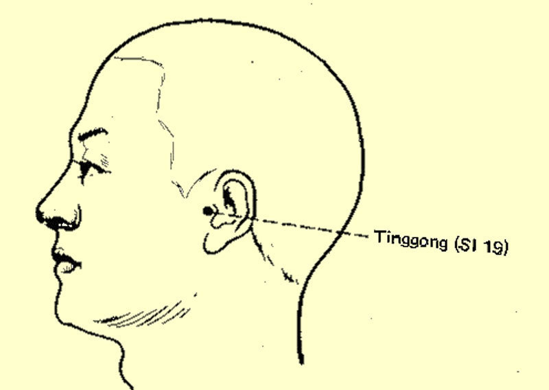 Точка рядом. Точки акупунктуры при шуме в ушах. Акупунктурная точка от шума в ушах. Точки от звона в голове. Точки массажа при шуме в ушах.