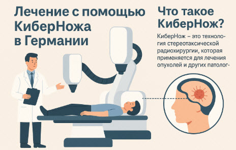 КиберНож в Германии