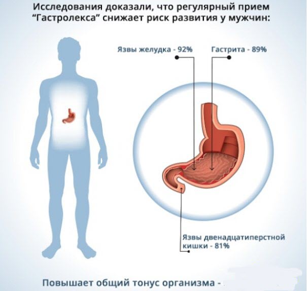 Гастролекс результат