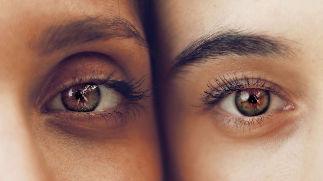 Необычные факторы, влияющие на возникновение темных кругов под глазами