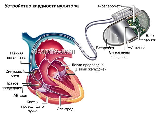 Все мы немного киборги киборги, прогресс, электроника и механика в теле человека