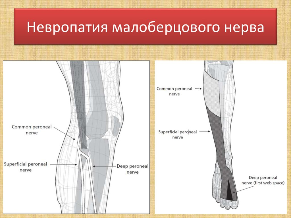 В прошлой статье мы рассказывали о глубокой работе по укреплению коленных суставов, когда вдруг появилась боль (тут>>>).-3