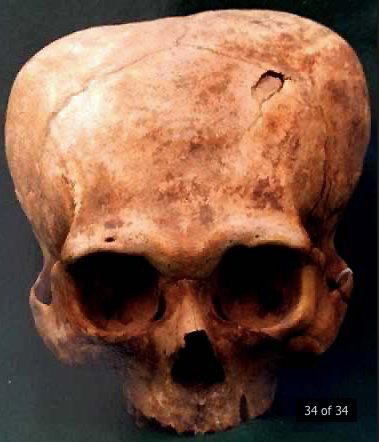 Жестокие эксперименты: в чём может быть причина деформации головы в древности